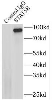 STAT5B Rabbit Polyclonal Antibody