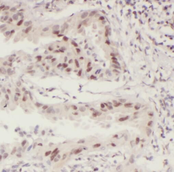 STAT5B Rabbit Polyclonal Antibody