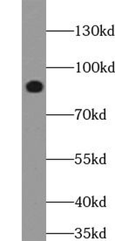 STIM1 Rabbit Polyclonal Antibody