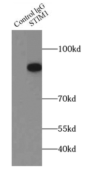 STIM1 Rabbit Polyclonal Antibody