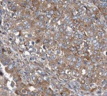 STIM1 Rabbit Polyclonal Antibody