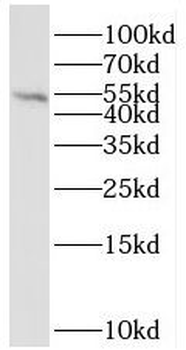 STK17A Rabbit Polyclonal Antibody