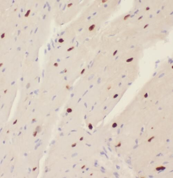 STK17A Rabbit Polyclonal Antibody