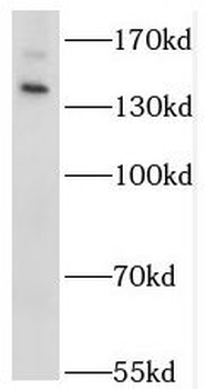 STK36 Rabbit Polyclonal Antibody