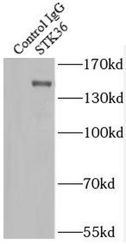 STK36 Rabbit Polyclonal Antibody