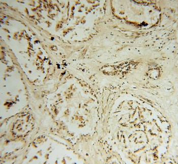 STK36 Rabbit Polyclonal Antibody