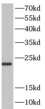 STMN2 Rabbit Polyclonal Antibody