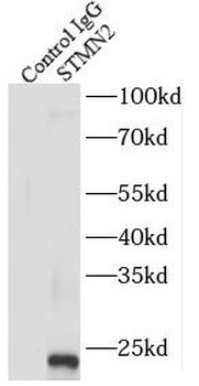 STMN2 Rabbit Polyclonal Antibody