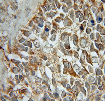 STMN2 Rabbit Polyclonal Antibody