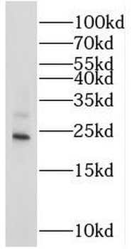 STMN3 Rabbit Polyclonal Antibody