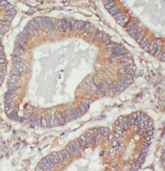 STMN3 Rabbit Polyclonal Antibody