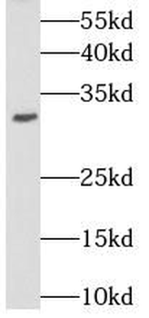 STOM Rabbit Polyclonal Antibody