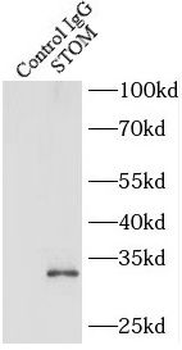 STOM Rabbit Polyclonal Antibody