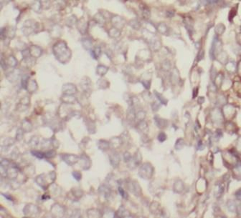 STOM Rabbit Polyclonal Antibody