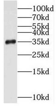 STUB1 Rabbit Polyclonal Antibody