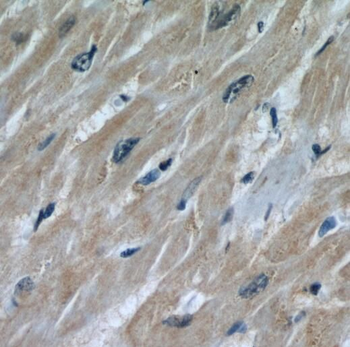 STUB1 Rabbit Polyclonal Antibody