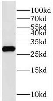 STXBP6 Rabbit Polyclonal Antibody