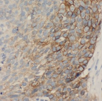 STXBP6 Rabbit Polyclonal Antibody