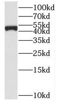 SUCLG2 Rabbit Polyclonal Antibody