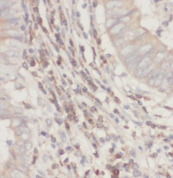 SUCLG2 Rabbit Polyclonal Antibody