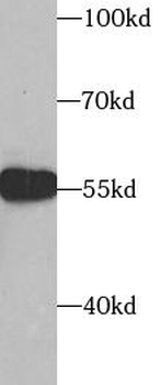 SUFU Rabbit Polyclonal Antibody