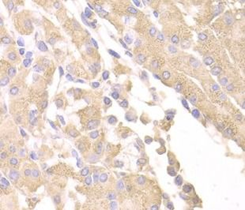 SUFU Rabbit Polyclonal Antibody