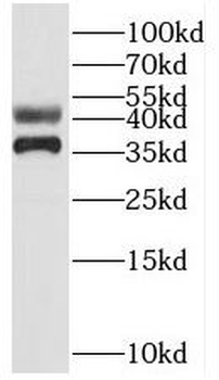 SUGT1 Rabbit Polyclonal Antibody