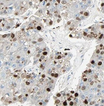 SUGT1 Rabbit Polyclonal Antibody