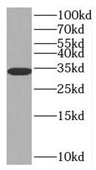 SULT1E1 Rabbit Polyclonal Antibody
