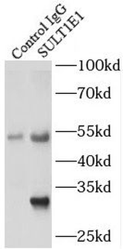 SULT1E1 Rabbit Polyclonal Antibody