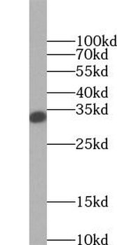 SULT2A1 Rabbit Polyclonal Antibody