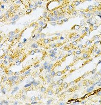 SULT2A1 Rabbit Polyclonal Antibody