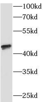 SUMF1 Rabbit Polyclonal Antibody