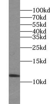 SUMO2/3 Rabbit Polyclonal Antibody