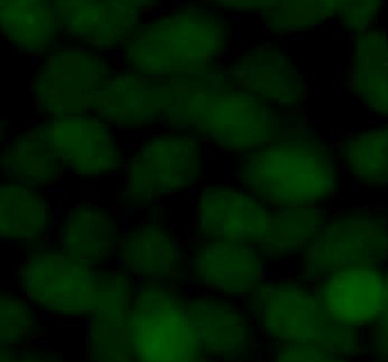 SUMO2/3 Rabbit Polyclonal Antibody