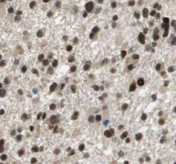 SUMO2/3 Rabbit Polyclonal Antibody