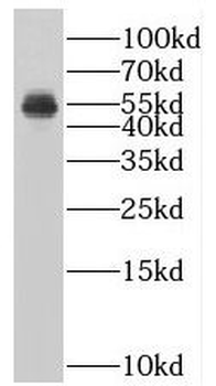 SUV39H1 Rabbit Polyclonal Antibody