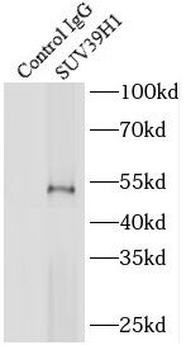 SUV39H1 Rabbit Polyclonal Antibody