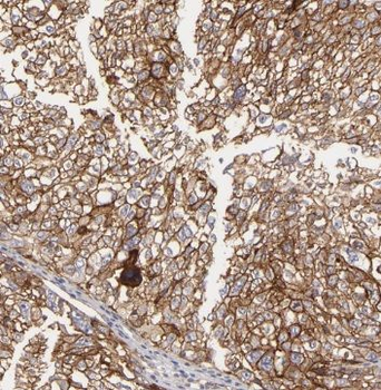 SYAP1 Rabbit Polyclonal Antibody