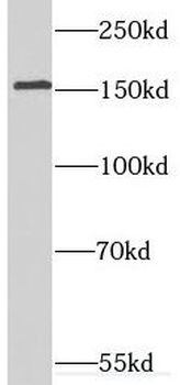 SYNGR2 Rabbit Polyclonal Antibody