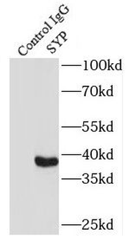 SYP Rabbit Polyclonal Antibody