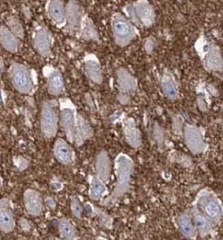 SYP Rabbit Polyclonal Antibody