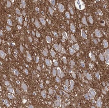 SYNPO Rabbit Polyclonal Antibody