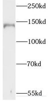 SYNJ1 Rabbit Polyclonal Antibody