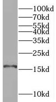 SYNJ2BP Rabbit Polyclonal Antibody