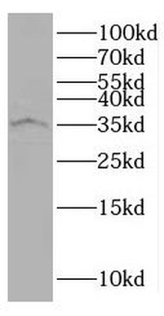 SDCBP2 Rabbit Polyclonal Antibody