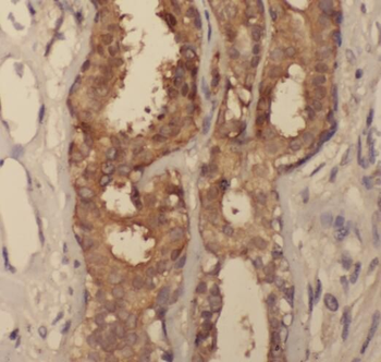 SDCBP2 Rabbit Polyclonal Antibody