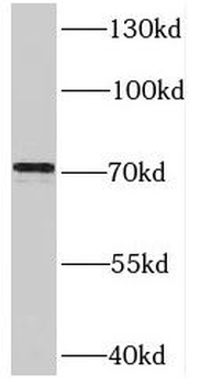 SYVN1 Rabbit Polyclonal Antibody
