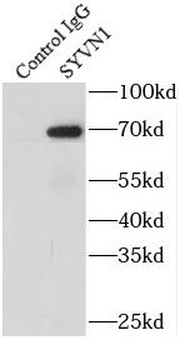 SYVN1 Rabbit Polyclonal Antibody