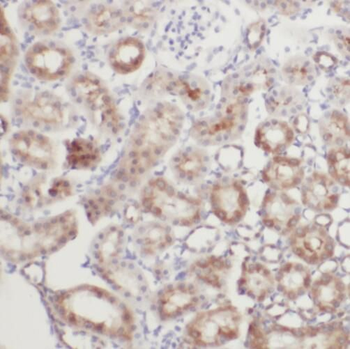SYVN1 Rabbit Polyclonal Antibody